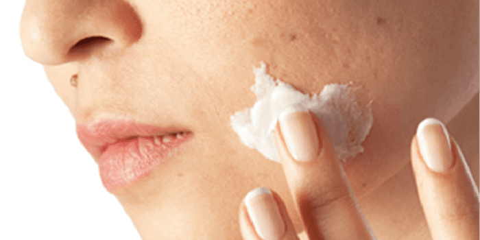 Freezing Off Skin Tags