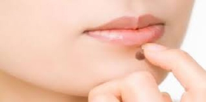 Home Remedies For Skin Tags