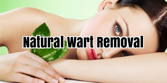 Natural Wart Removal