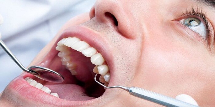 Read About Teeth Whitening Kits