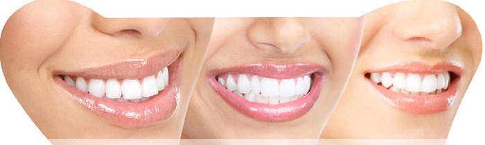 Home Remedies For Teeth Whitening