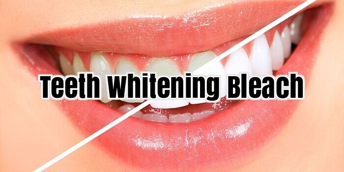 Teeth Whitening Bleach