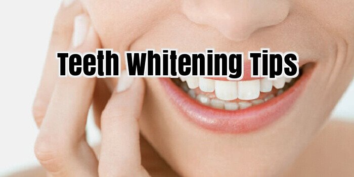 Teeth Whitening Tips