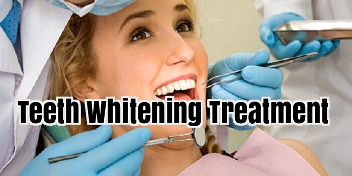 Teeth Whitening Treatment