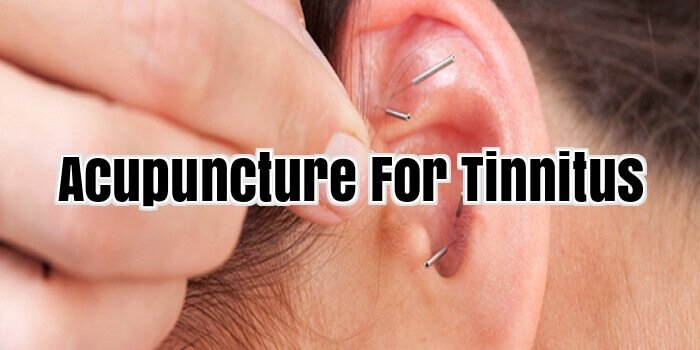 Acupuncture For Tinnitus