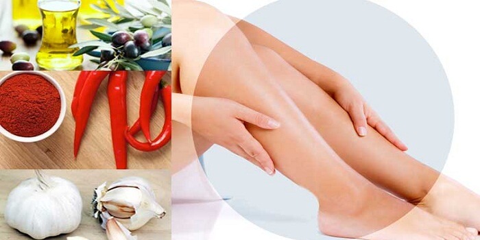 Home Remedies For varicose veins