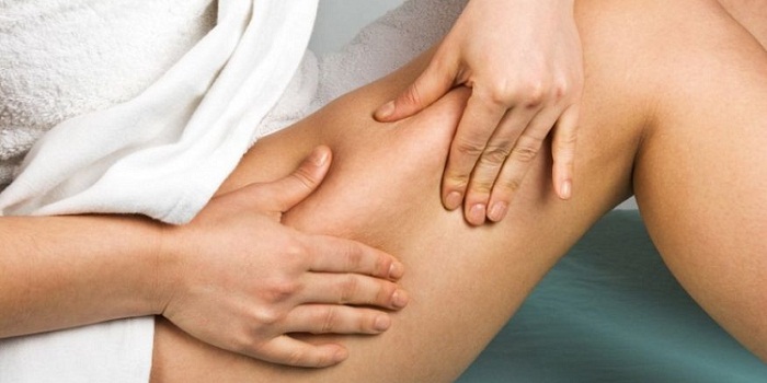 Ways To Prevent varicose veins