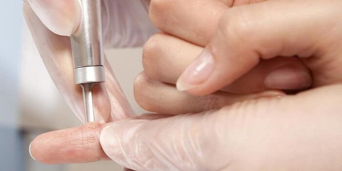 Types Of Wart Removal Procedures That Work