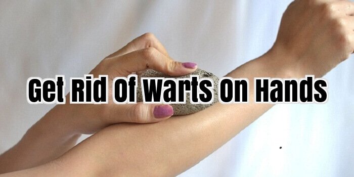 Get Rid Of Warts On Hands