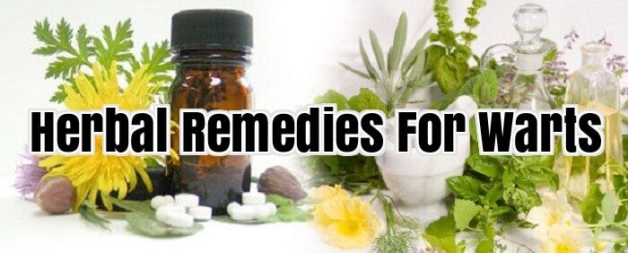 Herbal Remedies For Warts
