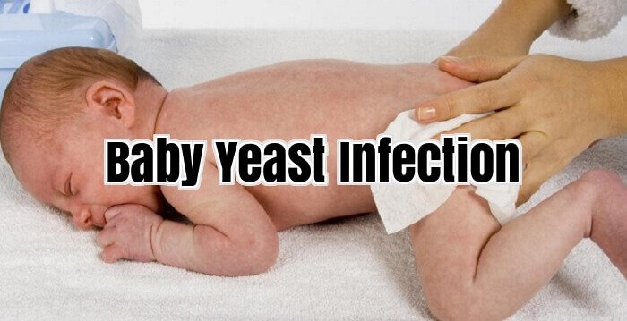 Baby Yeast Infection