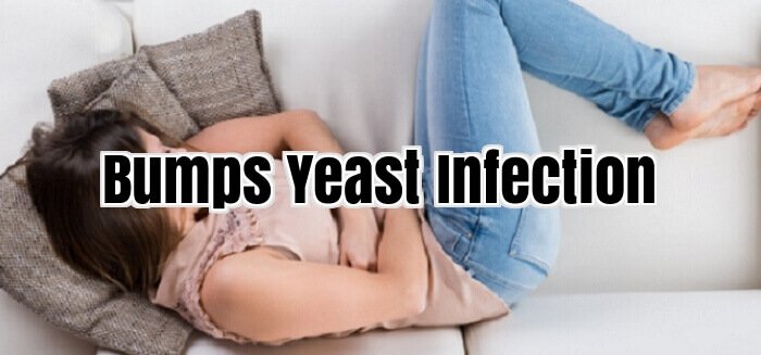 Bumps Yeast Infection