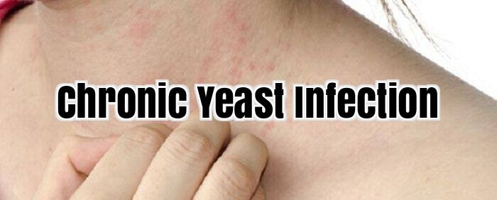 Chronic Yeast Infection
