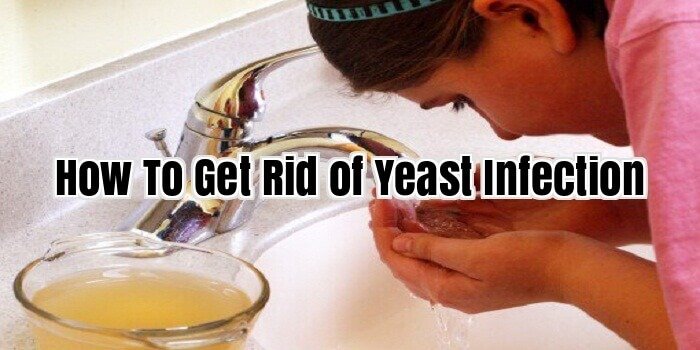 How To Get Rid of Yeast Infection