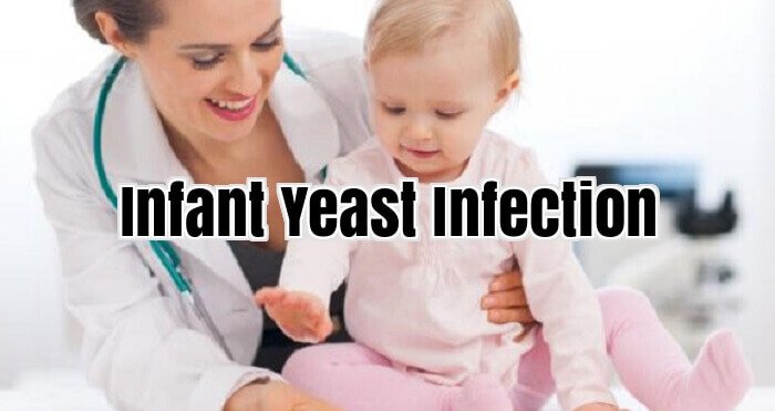 Infant Yeast Infection