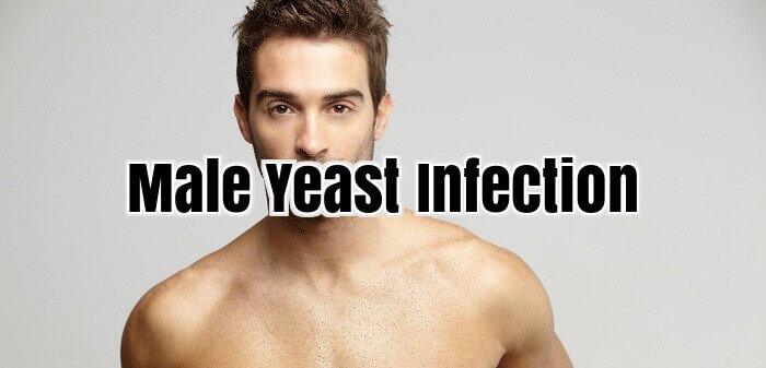Male Yeast Infection