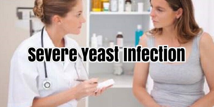 Severe Yeast Infection