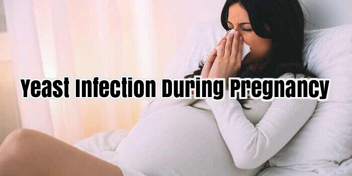Yeast Infection During Pregnancy