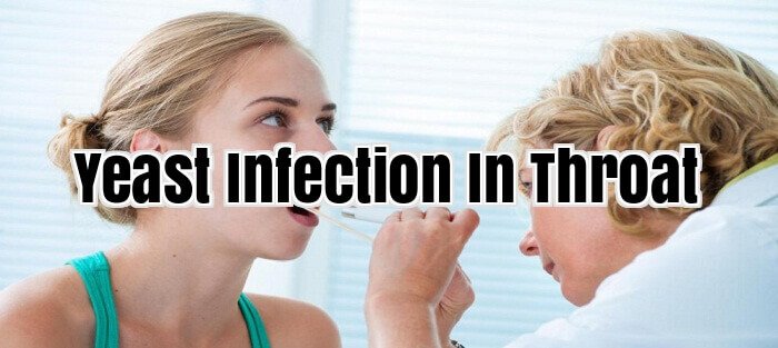 Yeast Infection In Throat