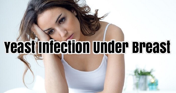 Yeast Infection Under Breast